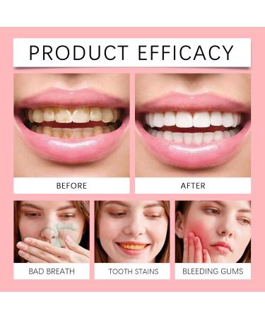 Gentle Cleaning Toothpaste - Daily Oral Care for Fresh Breath Deep Stain Removal & Teeth Brightening Foamy & Easy to Rinse Suitable for All Ages(2PCS) - Buy Online on GoSupps.com