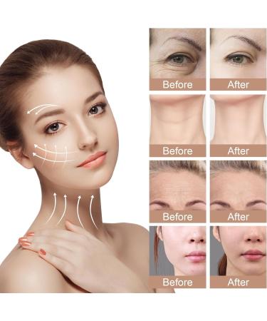 Foreverlily Red Light Therapy Face Massager | 3 Modes Microcurrent Device for Face & Neck | Anti-Aging LED Photon Therapy & Skin Tightening | EMS White - Buy Online on GoSupps.com