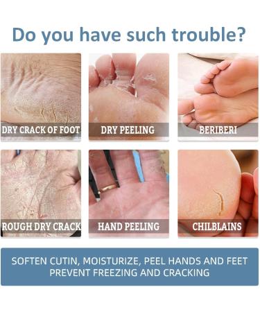 Urea 40% Foot Cream Cracked Heel Repair Cream Foot Cream for Cracked Heels and Dry Skin Cracked Heel Repair Cream Urea Foot Cream Foot Moisturiser Skin Care Hands & Feet Cracked Heel Cream Heel Repair - Buy Online on GoSupps.com