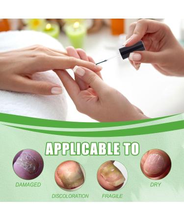 Keratin 3 Day Growth Nail Treatment Nail Strengthener for Damaged Nails Nail Growth Treatment Nail Repair Treatment Nail Strengthener and Growth Polish Nail Hardener for Thin & Brittle & Peeling Nails - Buy Online on GoSupps.com
