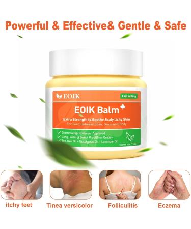 Heat Rash Cream  Eczema  Hand Foot Treat  Tinea Versicolor  Itchy Feet  Butt  Anal Itch  Psoriasis  Scalp Dandruff  Bee Sting  Bites  Boil Cyst  Armpit  Adults Kids  Hidradenitis Suppurativa Treat - Buy Online on GoSupps.com