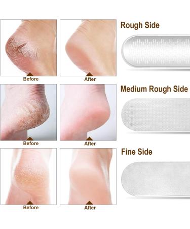 Foldable Foot Rasp File Callus Remover 3 in 1 Stainless Steel Pedicure Foot Scraper with 3 Sides to Remove Cracked Heels Hard Skin Smooth Feet Can Be Used Wet or Dry Skin(Champagne) - Buy Online on GoSupps.com
