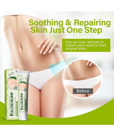 iTecFreely Keloid Scar Treatment for Nose & Belly Piercings - Silicone Scar Gel for Stretch Marks, Burns & Surgery Scars - Buy Online on GoSupps.com