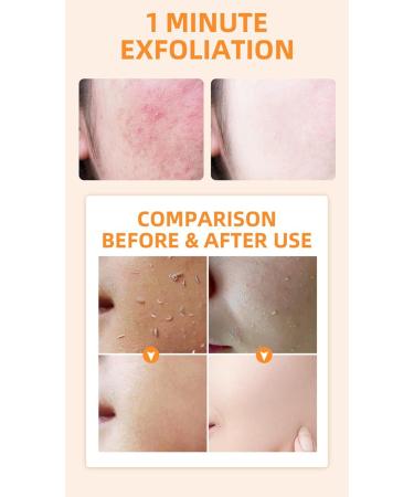 Buy Facial Orange Exfoliating Gel | Natural Peel Scrub for Deep Cleansing & Moisturizing - 2.02 fl. oz | QNJ - International Shipping Available - Buy Online on GoSupps.com