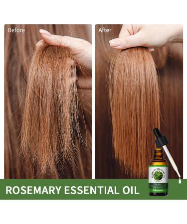 LADYFOX Organic Rosemary Oil - 100% Pure Natural Hair Growth & Skin Care 1.01 Fl Oz - Buy Online on GoSupps.com
