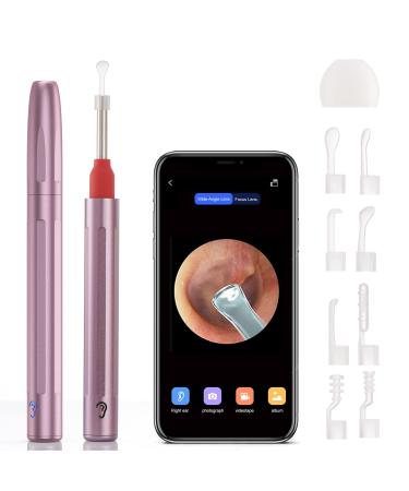 Ear Wax Removal 3.9mm Ear Otoscope 6 LED Lights Ear Cleaner Tool Wireless Connected Waterproof Compatible with iOS Android Smart Phones & Tablets for Adults Kids & Pets-Rose Gold