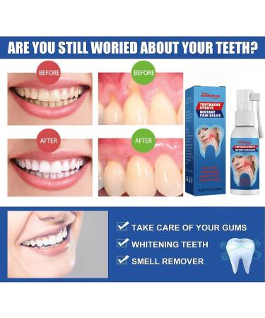 2PCS Toothache Relieving Spray Oral Care Spray Toothache Pain Relief for Adult for Teeth Health Instant Tooth Pain Relief Spray for Toothache Pain Spray for Toothache Relief Sore Gums Treatment - Buy Online on GoSupps.com