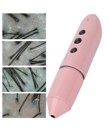 100X Magnification Skin Hair Scalp Detector | 2MP Camera Skin Health Analyser for Home & Salon Use - Buy Online on GoSupps.com
