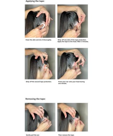 Cosmetic Ear Corrector - 30 Discreet Ear Stickers for Protruding Ears | Non-Surgical Ear Fix Solution - Buy Online on GoSupps.com