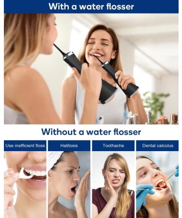 MySmile LP211 Cordless Water Flosser - 5 Modes Rechargeable Waterproof 8 Tips Portable Travel Case - Best Dental Care Device - Buy Online on GoSupps.com