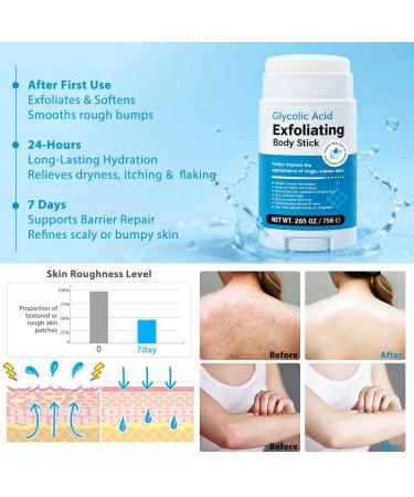 Glycolic Acid Exfoliating Body Stick 75g Body Cream & Exfoliator for Strawberry Skin Treatment on Legs Arms and Dry Rough Skin Reduces Acne with Shea Butter One Targeted Solution - Buy Online on GoSupps.com