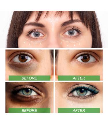 Eye Serum for Dark Circles & Bags | Hyaluronic Acid Anti-Aging Eye Cream for Men & Women (2PC) - Buy Online on GoSupps.com