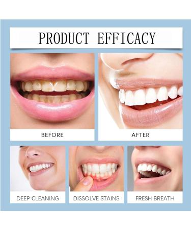  Opvonxeh Brightening Toothpaste Teeth Brightener Toothpaste Tooth Whitening Product Professional Oral Care Toothpaste Deep Cleaning Oral Toothpaste Teeth Whitening and Brightening for Men Women 4oz - Buy Online on GoSupps.com