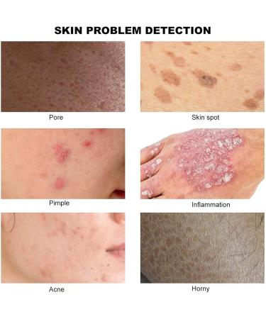 Coglyyds 7-Inch Skin & Hair Analyzer - Advanced Skin Health & Follicle Detector for Personalized Care | International Shipping - Buy Online on GoSupps.com