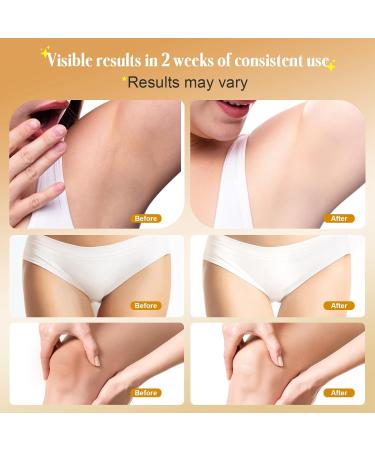 Skin Bleaching Cream for Body & Intimate Areas | Vitamin C Dark Spot Remover & Skin Whitening Solution - Buy Online on GoSupps.com