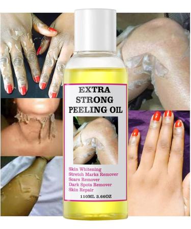 Eoixuqba 110ml Peeling Oil Extra Strength Whitening Yellow Peeling Oil Yellow Peeling Oil For Dark Skin Super Strength Yellow Peeling Oil Dark Skin For BodyFor Body Lightening Bleaching - Buy Online on GoSupps.com
