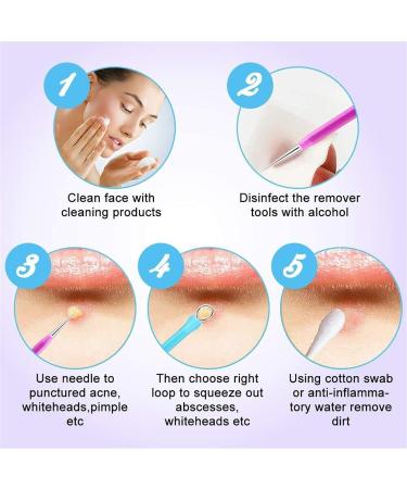 Acne Needle 10pcs Kit Stainless Steel Blackhead Remover Beauty Face Pimple Comedone Extractor Needle Clip Pore Cleaner (Color : Colorful 10pcs) - Buy Online on GoSupps.com