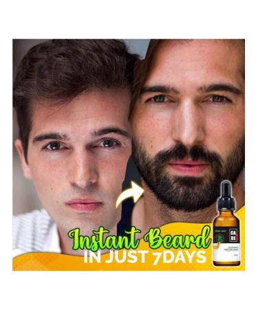 10x-Regro Strong Hair Serum - 50% Off! Natural Hair Growth Formula for Thinning & Balding - Promotes Thicker Hair - Buy Online on GoSupps.com