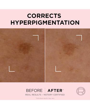 L'Oreal Paris Age Perfect Golden Age Rapid Spot Corrector for Mature Skin Niacinamide and Exclusive Peony Native Cells Reduces Appearance of Dark Spots 50ml - Buy Online on GoSupps.com