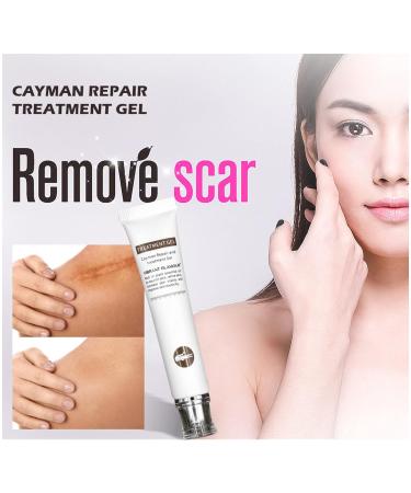 Vibrant Glamour Cayman Repair Gel: Acne Scar & Skin Scar Removal Ointment - 20g - Buy Online on GoSupps.com