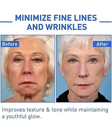 Botulinum-Free Botox Facial Serum Trio for Youthful Skin | Anti-Aging Solution - Buy Online on GoSupps.com