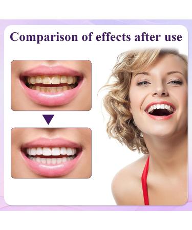 Roinaaid 2-Piece Teeth Whitening Pen Set | Fast & Painless Tooth Whitening at Home | Brighten Your Smile Effortlessly - Buy Online on GoSupps.com
