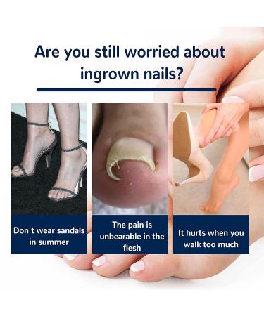 Fitmedify Ingrown Toenail Corrector Kit - Nail Patches for Ingrown Toenail Treatment and Removal - Buy Online on GoSupps.com