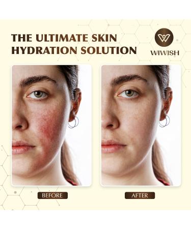 Beef Tallow & Honey Balm for Face | 100% Grass Fed Tallow Moisturizer | Natural Honey Lotion for Soft Smooth Skin - Buy Online on GoSupps.com
