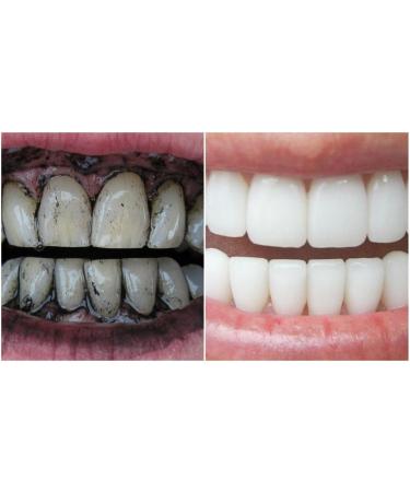 Bamboo Charcoal Toothpaste - Natural Teeth Whitener Eco-Friendly Oral Care International Shipping - Buy Online on GoSupps.com