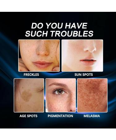 Aobenz Serum Aobenz Dark Spot Remover Black Spot Removing Facial and Body Essence: Senile Spot Advanced Male and Female Formula Containing Nicotinamide (3PC) - Buy Online on GoSupps.com