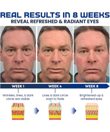 5 Pcs Men Eye Cream Tender Men Eye Gel Eye Gel for Lines Remove Puffiness Dark Circles Eye Lines with Hyaluronic Acid Centella Asiatica Extract Repair Sye Skin for Men Jildouf - Buy Online on GoSupps.com