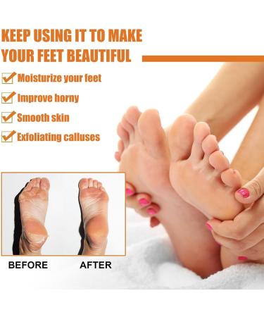 Spray exfoliant pour les pieds Huile d'orange P dicure Exfoliant pour peaux mortes Spray pour l' limination des callosit s des pieds Spray exfoliant instantan pour les pieds Quicky Remove Dead Skin - Buy Online on GoSupps.com
