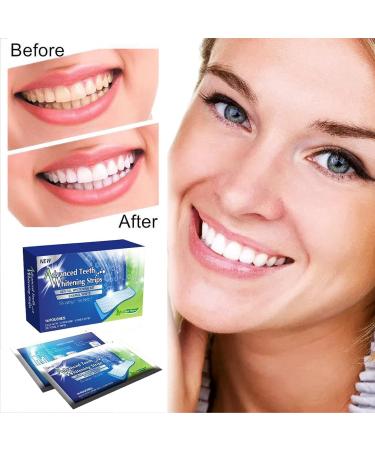 Peroxide-Free Tooth Whitening Strips | Natural Formula Safe for Enamel | 14 Pieces for Quick Spot Removal - Buy Online on GoSupps.com