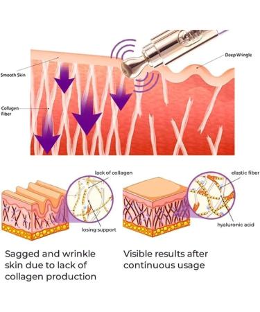 Milk spots soothe electric serum pen Eye cream Electric serum Electric serum pen Moisturizing Anti-aging cream to reduce milk spots and sagging eyes - Buy Online on GoSupps.com
