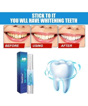Teeth Whitening Pen Set - 5 PCs | Instant Gum Treatment Gel | Safe Tartar Removal & Brightening for Adults - Buy Online on GoSupps.com