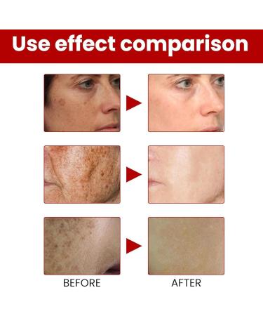  Yhsioaklo Skin Whitening Cream with Natural Kojic Acid 30g Illumination Moisturizer for Face Body Dark Cleanser Hyperpigmentation Brightening Creams Skin Tone Firming P - Buy Online on GoSupps.com