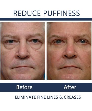 Veze Eye Cream for Men and Women - Moisturizing, Firming, and Reduce Eye Bags - 5PCS - Buy Online on GoSupps.com