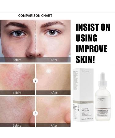 Hyaluronic Acid 2% + B5 Skincare Hyaluronic Acid Serum Face Serum for Women Moisturiser Face Face Serum Hyaluronic Acid Anti Aging Serum for Face Brightening Serum Face Serums Plump and Smooth Skin - Buy Online on GoSupps.com