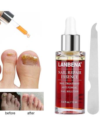 Nail Repair Essence 12ml - Natural Anti-fungus Treatment for Effective Nail Repair - Buy Online on GoSupps.com