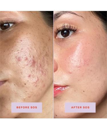 Tower 28 SOS Daily Facial Spray | Travel-Size | Soothe Irritation and Inflammation | pH Balancing Toner | Hypochlorous Acid | 1 Fl Oz - Buy Online on GoSupps.com