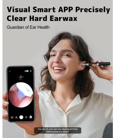 Ear Wax Removal Kit with Camera - Earwax Remover Tool for iOS & Android - Black - Buy Online on GoSupps.com