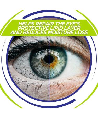 Reckitt Optrex ActiMist Double Action eye spray for tired and tense eyes refresh and protect eye spray longlasting relief pack of 3 x 10 ml eye spray - Buy Online on GoSupps.com