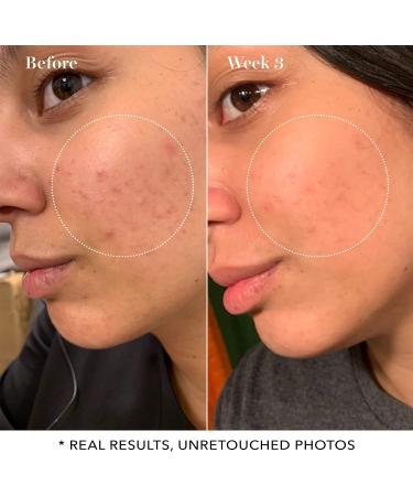 Saturady Skin Pore Clarifying Toner - 10% Glycolic Acid & AHA, 4.22 Fl Oz - Deep Cleansing Facial Astringent Toner for Purifying & Reconditioning Skin - Buy Online on GoSupps.com