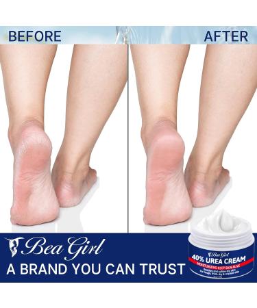 Urea Cream 40% for Intensive Foot Repair & Callus Remover - Softens and Moisturizes Dry Cracked Feet - Buy Online on GoSupps.com