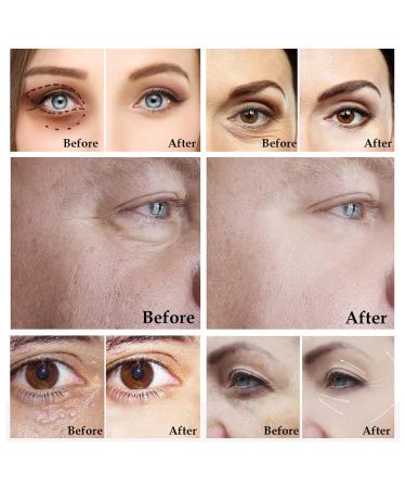 HMDABD Fine Recovery Circles Bags Puffy Under Eyes Firming Facial Brightening Eye For Aging Dark Circles Bags Puffy Under Eyes Firming Facial Brightening Eye Beauty Skin Care (Z6-A One Size) - Buy Online on GoSupps.com