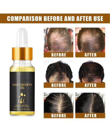 2024 New Folix 22 Hair Growth S rum de croissance des cheveux formule de croissance des cheveux huile de croissance des cheveux biotine s rum paississant base d'herbes huile de croissance des 3 pi ces - Buy Online on GoSupps.com
