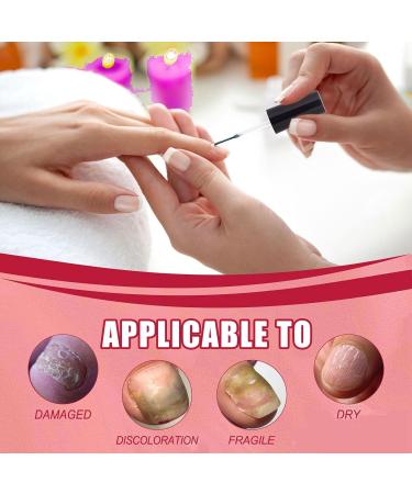 Nail Strengthener for Damaged Nails Crack Nail Repair Nail Polish Strengthener Nail Repair Essence Serum Strengthening Hardening Conditioner Extreme Strength Nail Serum Nail Repair&polish Treatment - Buy Online on GoSupps.com