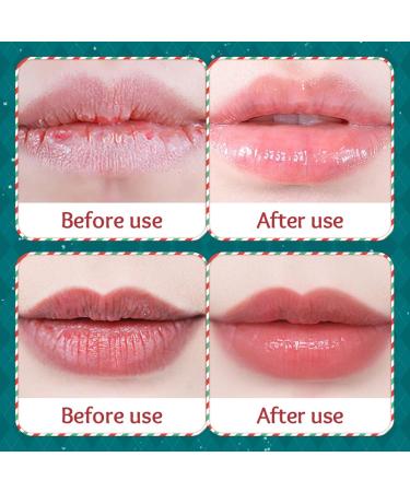 Natural Lip Balm & Exfoliator Set | Nourishing Treatment for Dry Dark Lips | Perfect Christmas Gift for Women & Girls - Buy Online on GoSupps.com