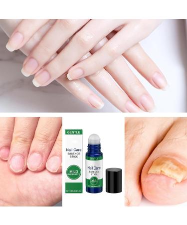 Nail Repair Stick 10ml Nail Protector | Unisex Stick for Daily Care Travel Manicure Salon - Buy Online on GoSupps.com