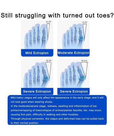 Bunion Corrector for Women & Men | Adjustable Bunion Splint with Soft Silicone Pad for Big Toe Relief - White Black Buckle - Buy Online on GoSupps.com